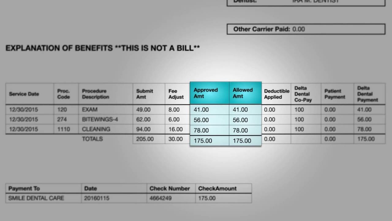 Maximums - Delta Dental For Individuals And Families